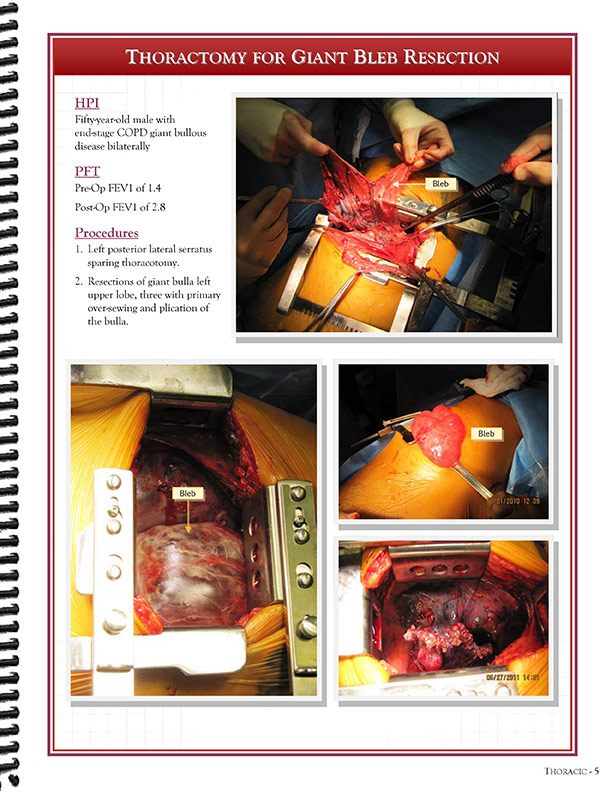 Cardiothoracic Surgeons' 
Case Studies Referral Booklet