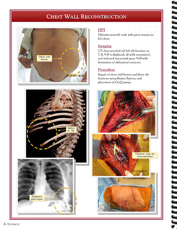 Cardiothoracic Surgeons' 
Case Studies Referral Booklet