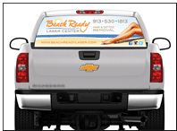 Laser Hair & Tattoo Removal Window Wrap